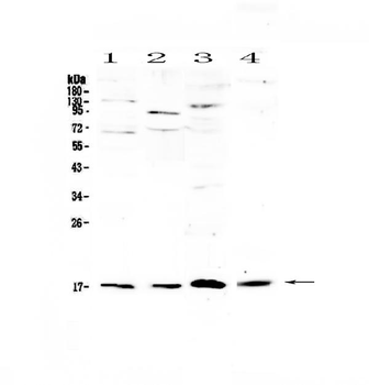 IL1F10 Rabbit Polyclonal Antibody