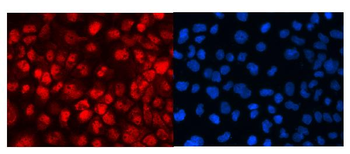 MED18 Rabbit Polyclonal Antibody