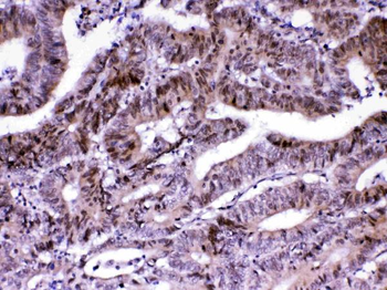 MED18 Rabbit Polyclonal Antibody