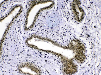 MED18 Rabbit Polyclonal Antibody