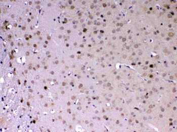 MED18 Rabbit Polyclonal Antibody