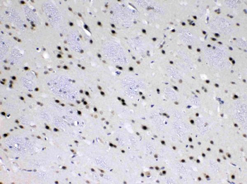 MED18 Rabbit Polyclonal Antibody