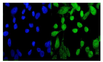 MED9 Rabbit Polyclonal Antibody