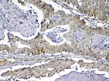 MED9 Rabbit Polyclonal Antibody