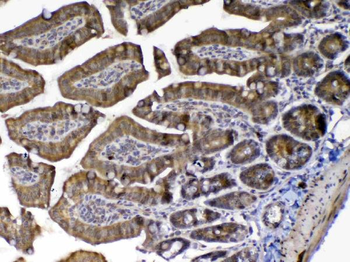 MED9 Rabbit Polyclonal Antibody