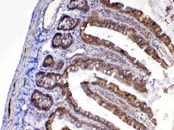 MED9 Rabbit Polyclonal Antibody