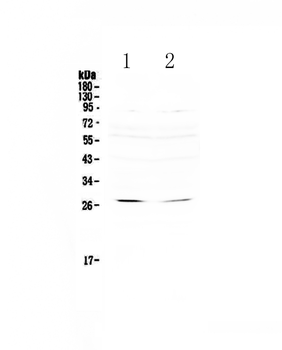 RNF186 Rabbit Polyclonal Antibody