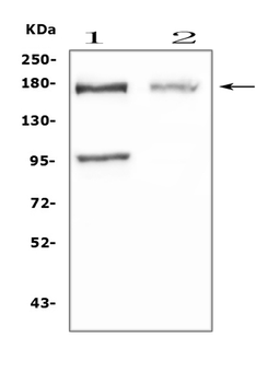 Niemann Pick C1/NPC1 Rabbit Polyclonal Antibody