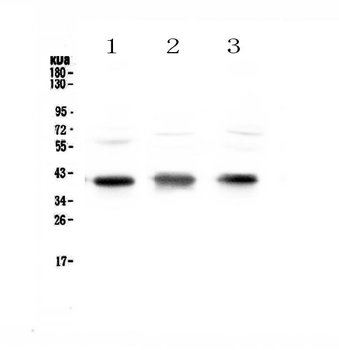 CCR4 Rabbit Polyclonal Antibody
