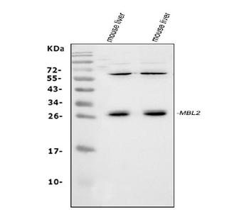 MBL2 Rabbit Polyclonal Antibody