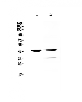 Cathepsin D/Ctsd Rabbit Polyclonal Antibody