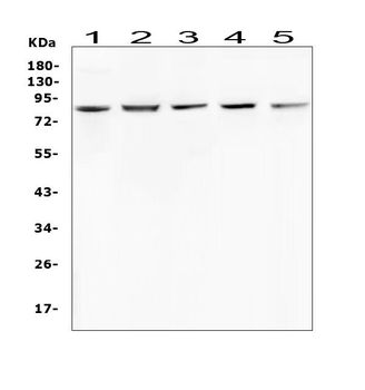 RNF43 Rabbit Polyclonal Antibody