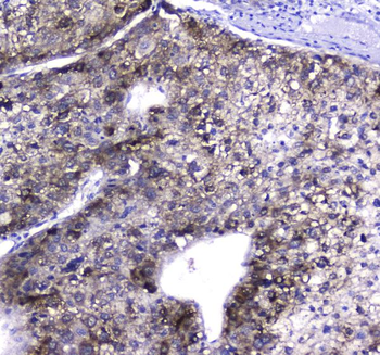 HGD Rabbit Polyclonal Antibody