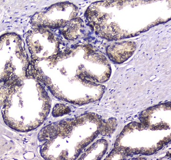 HGD Rabbit Polyclonal Antibody