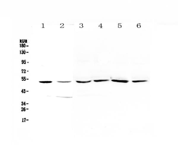 HGD Rabbit Polyclonal Antibody