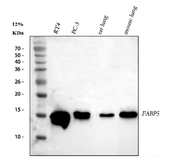 Fatty Acid Binding Protein 5/FABP5 Rabbit Polyclonal Antibody