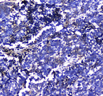 LGALS3BP Rabbit Polyclonal Antibody