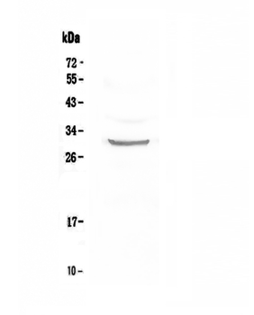 FRA1/FOSL1 Rabbit Polyclonal Antibody