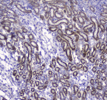 COX IV/COX4I1 Rabbit Polyclonal Antibody