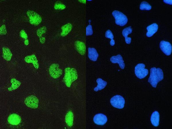 BRG1/SMARCA4 Antibody