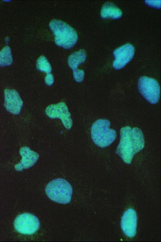 BRG1/SMARCA4 Antibody