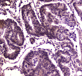 BRG1/SMARCA4 Antibody