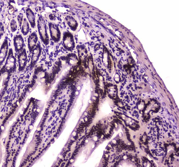 BRG1/SMARCA4 Antibody