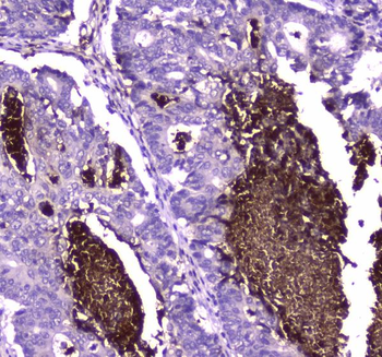 Lactoferrin/LTF Rabbit Polyclonal Antibody