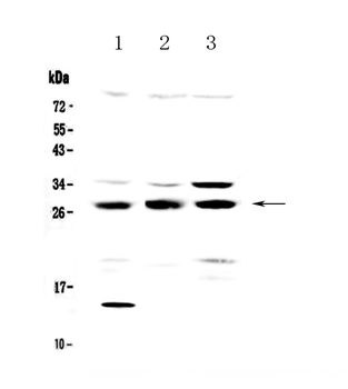 TPMT Rabbit Polyclonal Antibody