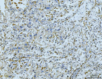 CD163 Antibody