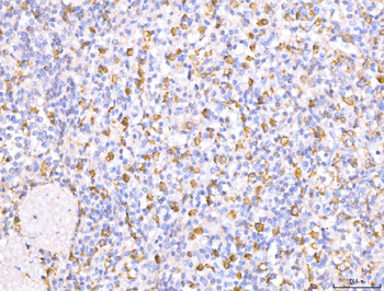 CD163 Antibody