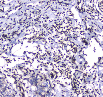 GFI1 Rabbit Polyclonal Antibody