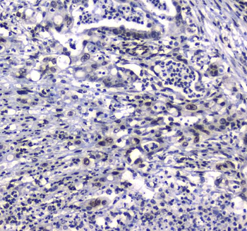GFI1 Rabbit Polyclonal Antibody