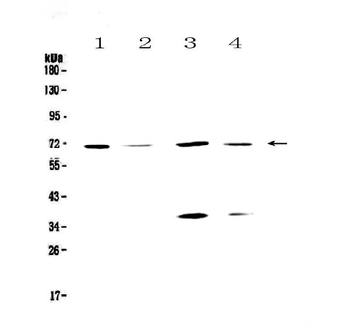 DNA Polymerase lambda/POLL Rabbit Polyclonal Antibody