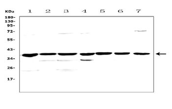 uPA Receptor/Plaur Rabbit Polyclonal Antibody