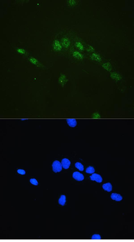 CBFb Rabbit Polyclonal Antibody