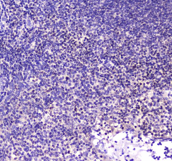 CBFb Rabbit Polyclonal Antibody