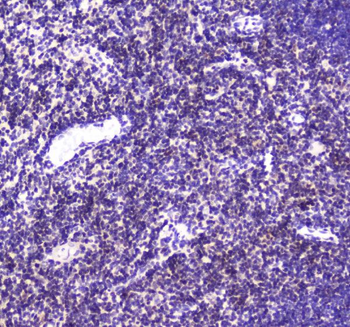 CBFb Rabbit Polyclonal Antibody