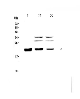 CBFb Rabbit Polyclonal Antibody