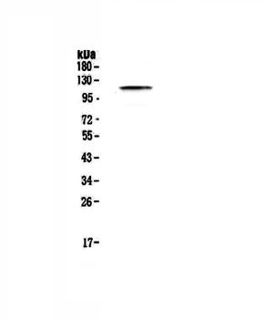 PMS2 Rabbit Polyclonal Antibody