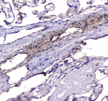 PDE4D Rabbit Polyclonal Antibody