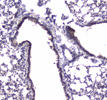 PDE4D Rabbit Polyclonal Antibody