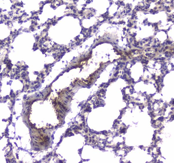 PDE4D Rabbit Polyclonal Antibody
