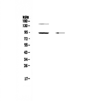 PDE4D Rabbit Polyclonal Antibody
