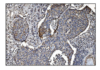 CLPP Rabbit Polyclonal Antibody