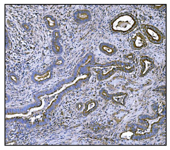 CLPP Rabbit Polyclonal Antibody