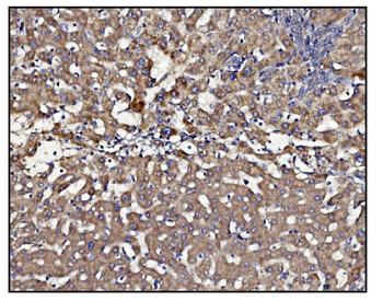 CLPP Rabbit Polyclonal Antibody