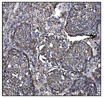 CLPP Rabbit Polyclonal Antibody