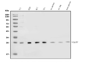 CLPP Rabbit Polyclonal Antibody