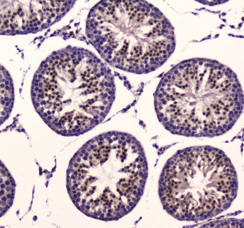 Mitochondrial Pyruvate dehydrogenase kinase 1/PDK1 Rabbit Polyclonal Antibody
